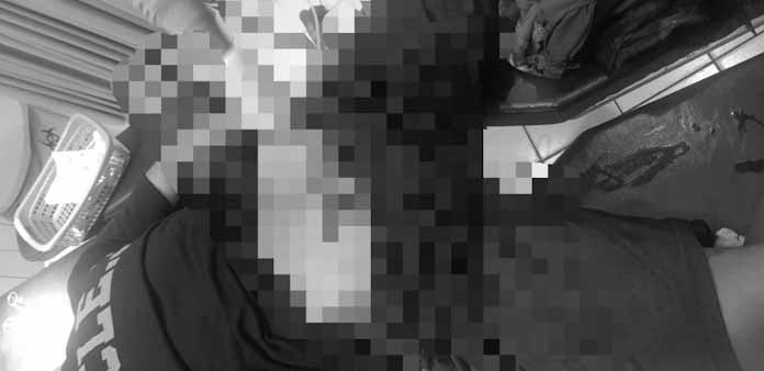 Istri Potong Kemaluan Suaminya, Langsung Geger Di Group WhatsApp