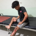 Leher Pengendara Motor Terjerat Kabel WiFi di Cibadak , Keluarga Korban Minta Perusahaan Bertanggung Jawab